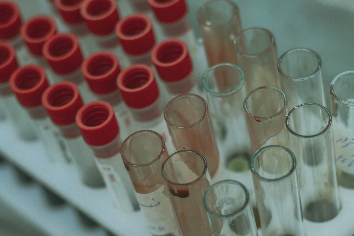 Eprubete medicale într-un cadru de laborator, simbol pentru analizele de sânge